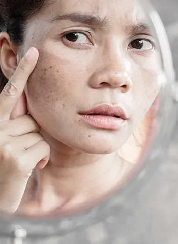 vape face Is Vaping To Blame For A Rise In Skin Complaints? main image 1